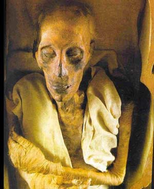 علت‌ مرگ‌ فرعون‌ ۵ هزار ساله‌