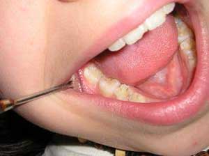 بهداشتکار دهان و دندان