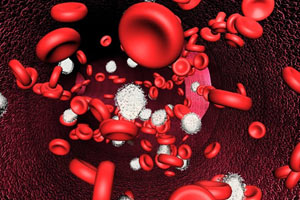 آنچه باید درباره کم خونی بدانیم