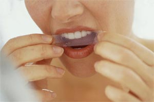 محدودیت سفیدکننده‌های خانگی دندان