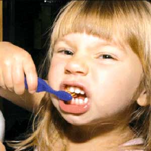 اوتیسم علیه دهان و دندان