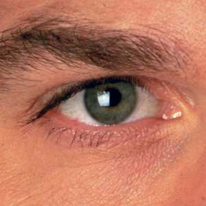 خشکی چشم، شایع ترین بیماری چشمی