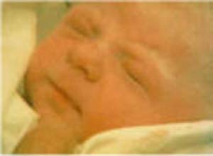 ۳ مرداد ـ ۲۵ جولای ـ نخستین کودک نخستین کودک " لوله آزمایشی " جهان در منچستر به دنیا آمد