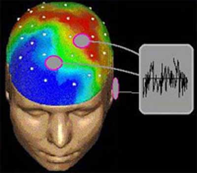 تاثیر موسیقی بر مغز انسان