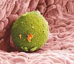 آشیانه ای برای سلول های سرطانی
