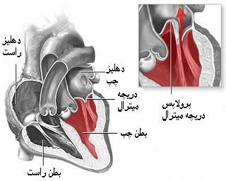 پرولاپس ( افتادگی ) دریچه میترال قلب