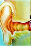 تغییرات هدایت استخوانی پس از بازسازی زنجیره استخوانچه‌ای گوش میانی