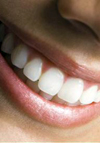 بررسی وضعیت سلامت دندان ها و انساج پریودنتال افراد ساکن در مناطق دارای پرتوزایی طبیعی بالا در مقایسه با منطقه کنترل در شهرستان رامسر سال (۸۳-۱۳۸۲)