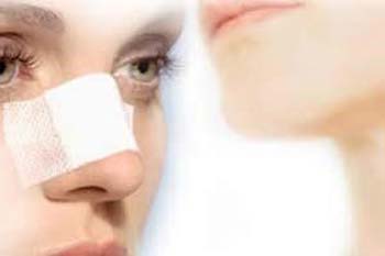 عوارض جراحی بینی در زیبایی