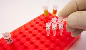 واکنش‌ زنجیره‌ پلی‌مراز PCR