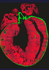 کارایی اکسی توسین در تمایز سلول های بنیادی P۱۹cl۶ به سلول های قلبی ضربان دار