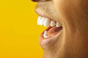 مواد سفیدکننده دندان: با خطر یا بی‌خطر؟