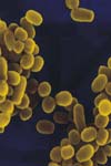 بیان پروتیین نو ترکیب P۳۹ بروسلا آبورتوس در باکتری اشریشیاکلی