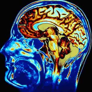 ضربه های مغزی : علت ها و درمان