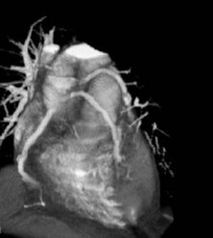 راهیابی به اعماق قلب ؛ معرفی روش کاتتر آنژیوگرافی