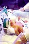 گزارش یک مورد نوزاد مبتلا به زردی شدید به علت خونریزی دو طرفه غده فوق کلیه