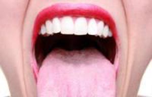 علل خشکی دهان