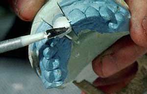 اندودنتیکس«تخصص درمان ریشه دندان»