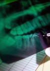 بررسی فراوانی آلودگی باکتریایی و رعایت اصول کنترل عفونت در دستگاههای رادیوگرافی موجود در مراکز دندانپزشکی شهر همدان