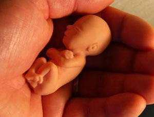 توریسم سقط جنین و گسترش فزاینده نگرانی های اخلاقی پیرامون آن