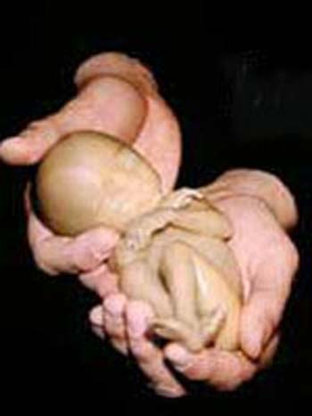 بررسی احکام سقط جنین یا سقط حمل
