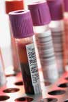 فراوانی آنتی‌بادی‌های ضد سیتومگالوویروس در اهداکنندگان خون ارومیه
