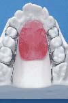 بررسی تنش ایجاد شده درPDL دندان‌های قدامی مگزیلا به هنگام اعمال نیروی اینتروزیو در دیستال دندان نیش