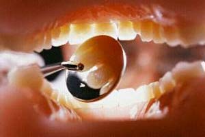 بهداشت نامطلوب دهان و دندان عامل بروز بیماری ها