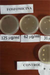 مقایسه تفاوت‌های فسفومایسین و فوزباک در محیط آزمایشگاهی