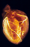 انتخاب فیلتر در تصویربرداری از خونرسانی عضله قلب با ۹۹mTc-MIBI بروش SPECT