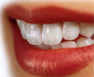 چگونه دندانهای زیبا داشته باشیم؟
