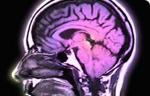با پیشرفت آلزایمر و دیگر بیماریهایی که منجر به تخریب عملکرد مغز می‌شوند