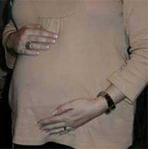 کمبود اسید فولیک در حاملگی