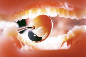 آینده لیزر در دندانپزشکی