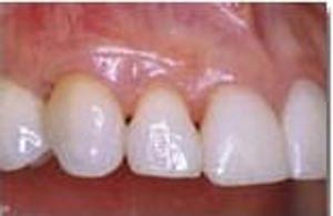 بافت نگهدارنده دندان چیست ؟