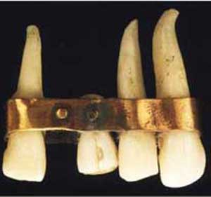 تاریخچه دندانپزشکی جهان
