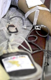 شیوع عفونت‌های منتقله از طریق خون در اهداکنندگان رشت