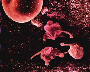 بیماری های عصر جدید تراژدی جنگ میکروبی آمریکا