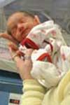 امید به حیات و بروز عوارض در نوزادان با وزن تولد کمتر از ۱۰۰۰ گرم
