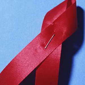 اثر داروی حصا آ بر بیماران مبتلا به ایدز