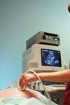 تعیین معیار سونوگرافی محیط شکم و تخمین وزن جنین در مادران باردار