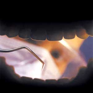 تجهیزات دندانپزشکی پرتابل :همراه همیشگی دندانپزشک