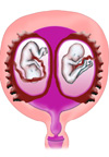 تعیین فراوانی مول مقاوم در مبتلایان به بیماریهای ترفوبلاستیک بارداری