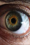 بررسی سطح آگاهی مردم از بیماریهای چشمی در یک نمونه یکهزار نفری از جمعیت شهری زنجان در سن بالای ۱۵ سال