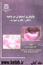 پاتولوژی استخوان در ناحیه دهان، فک و صورت