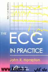 The ECG in practice