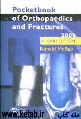 Pocketbook of orthopaedics and fractures