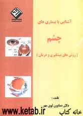آشنایی با بیماری چشم (روشهای پیشگیری و درمان)