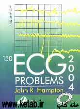 150 ECG problems