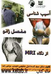 آسیب‌شناسی زانو از نگاه MRI